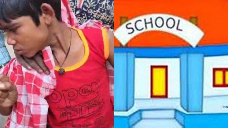 उबलते खीर में गिरने से बालक घायल, डीईओ ने जांच के दिए निर्देश